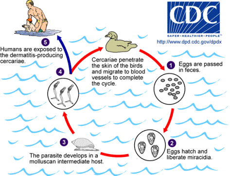 Cercarial Life Cycle - Swimmers Itch Parasite (CDC Graphic)