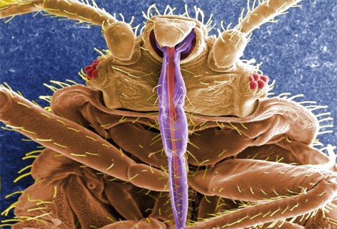 Cimex lectularius - The Bed Bug As seen Using A Scanning Electron Microscope 