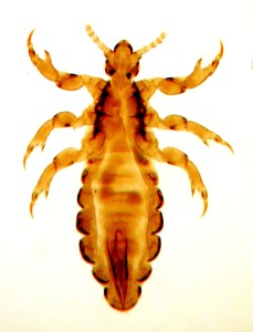 Male Head Louse