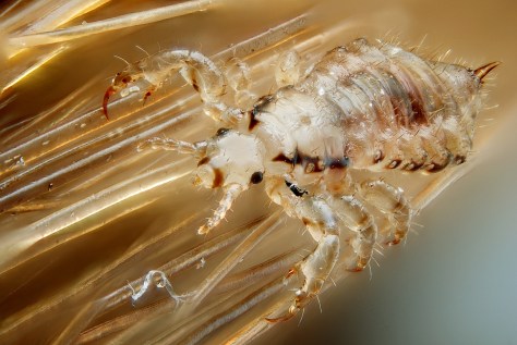 Male human head louse going for a bloodsucking stroll